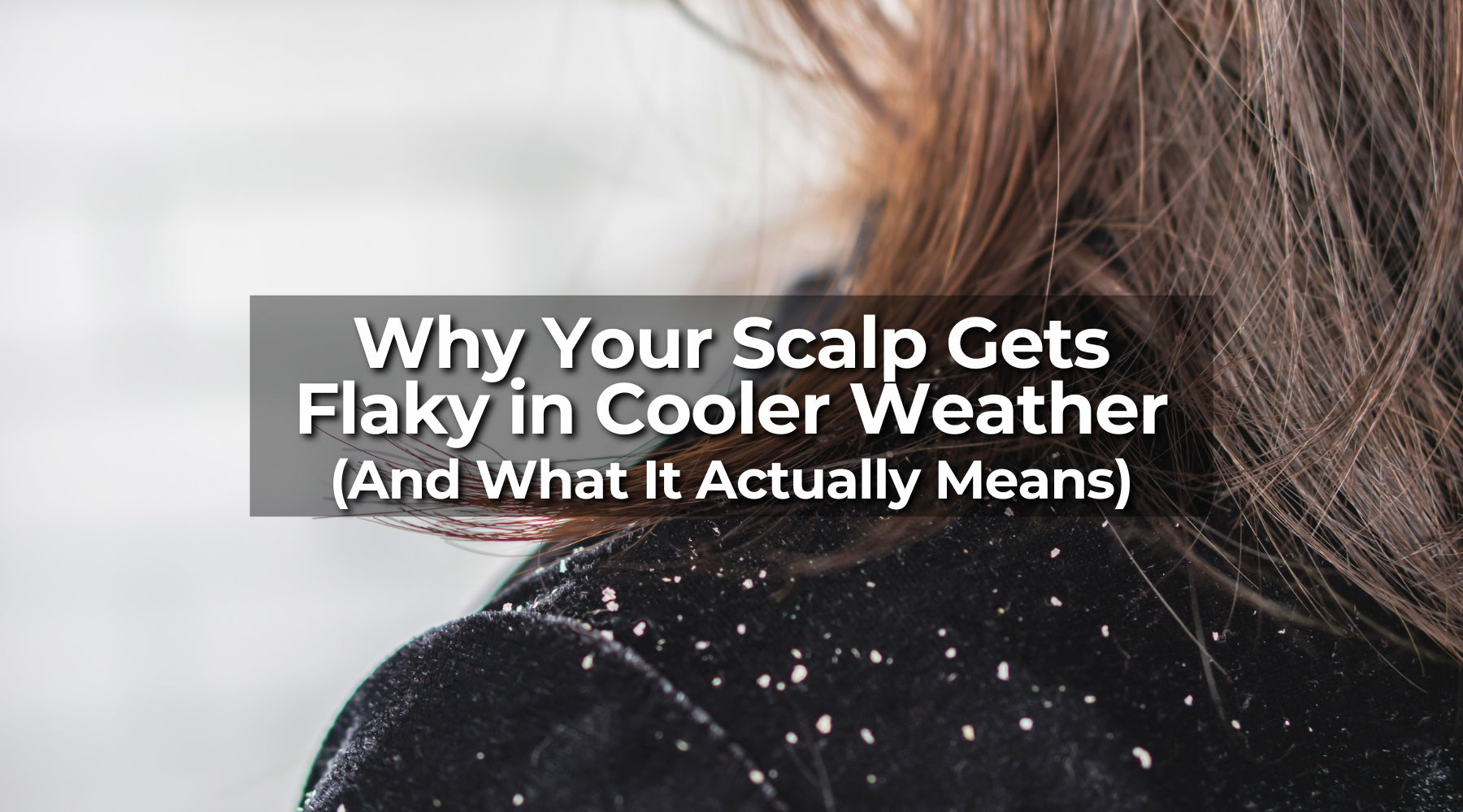 Why Your Scalp Gets Flaky in Cooler Weather (And What It Actually Means)